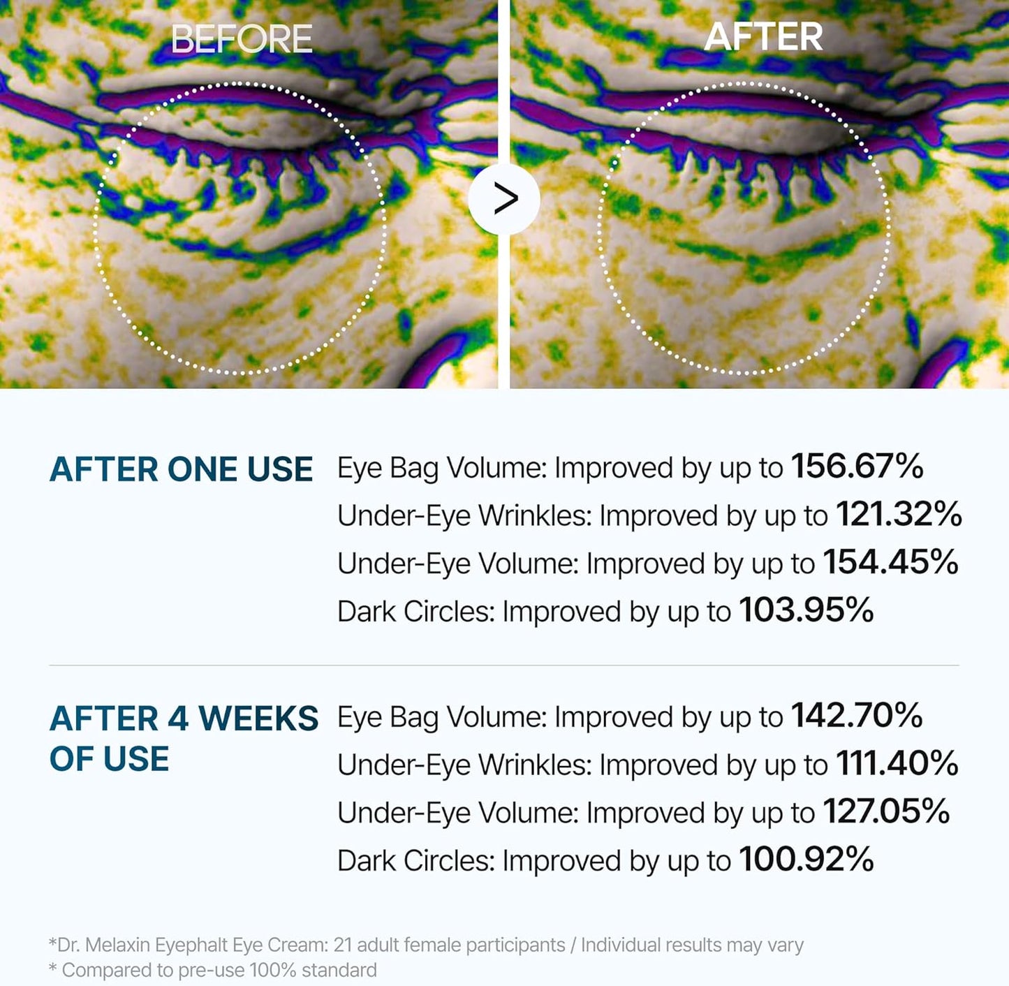 Dr.Melaxin Eyephalt Eye Bag Cream — Dark Circles, Puffiness & Fine Lines | EGF + Niacinamide + Ceramide