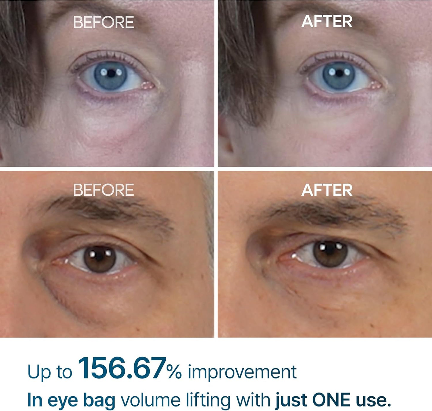 Dr.Melaxin Eyephalt Eye Bag Cream — Dark Circles, Puffiness & Fine Lines | EGF + Niacinamide + Ceramide